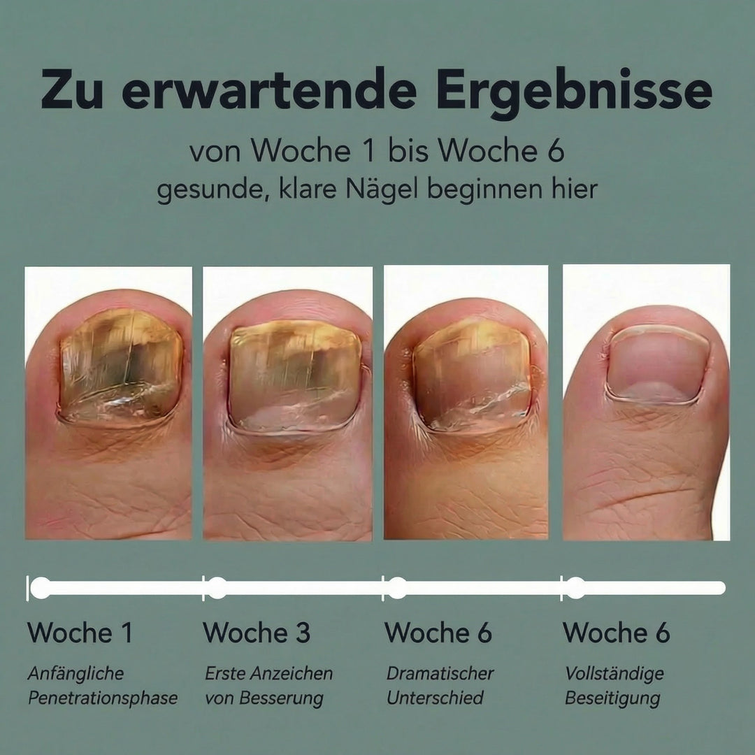 ELAIMEI® Fussnagel Patches