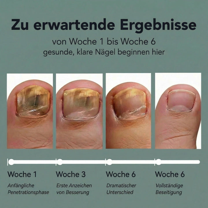 ELAIMEI® Fussnagel Patches
