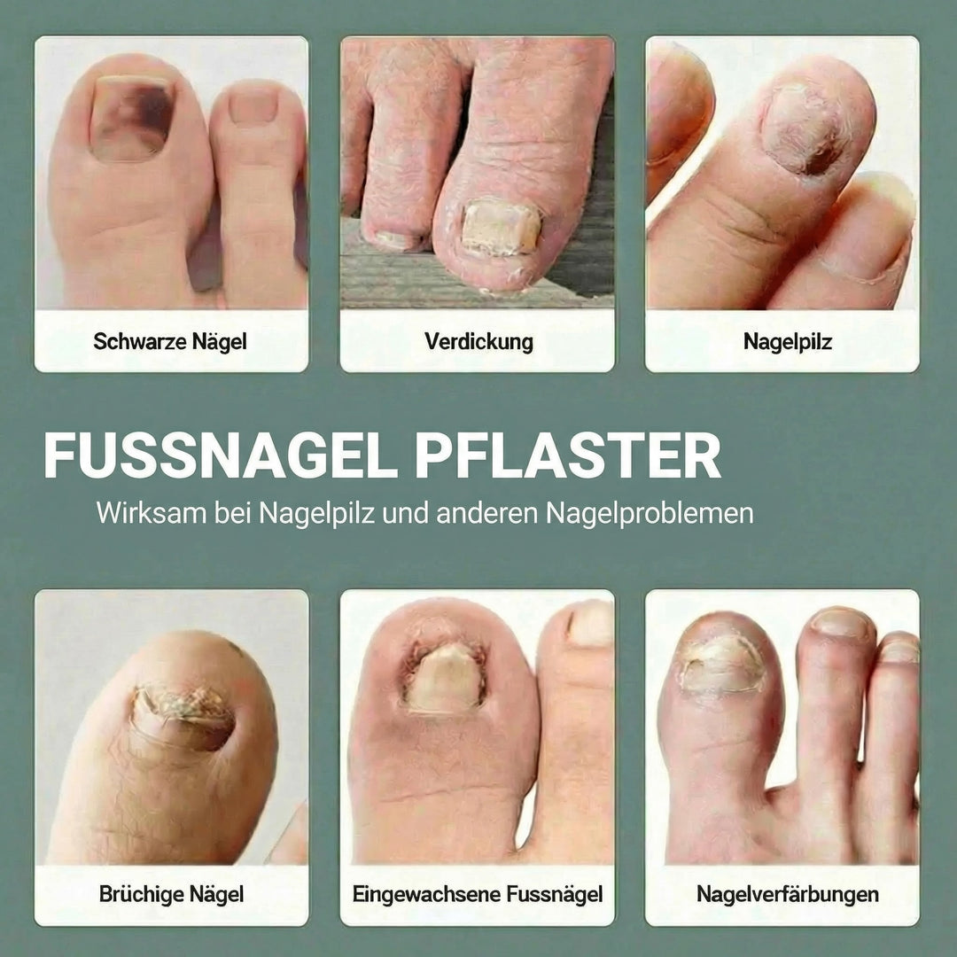 ELAIMEI® Fussnagel Patches